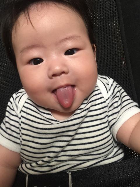 赤ちゃん 舌 黄色