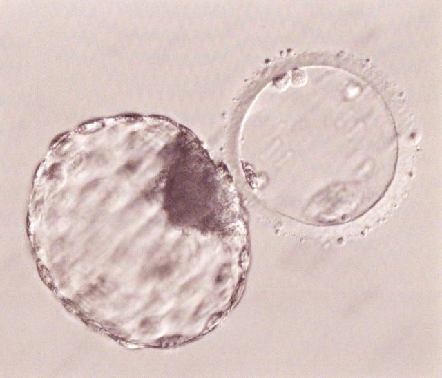 胚盤胞って何?グレードがあるの?着床率に影響はある? swell(スウェル)|妊活・妊娠・育児を応援する口コミ投稿サイト 胚盤胞って何?グレードがあるの?着床率に影響はある? swell(スウェル)|妊活・妊娠・育児を応援する口コミ投稿サイト